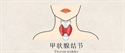 Picture of Thyroid Nodules